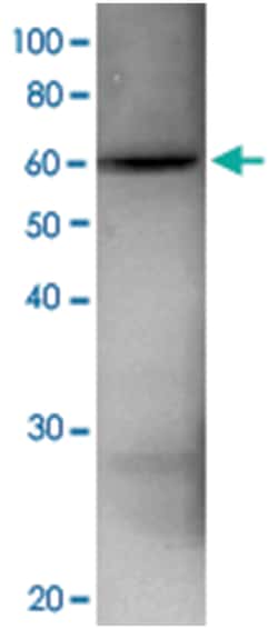 RPN3, Rabbit, Polyclonal Antibody, Abnova 100&mu;L; Unlabeled:Antibodies,
