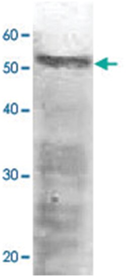 RPN5, Rabbit, Polyclonal Antibody, Abnova 100&mu;L; Unlabeled:Antibodies,