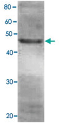 RPN7, Rabbit, Polyclonal Antibody, Abnova 100 &mu;L | Buy Online | Abnova | Fisher Scientific