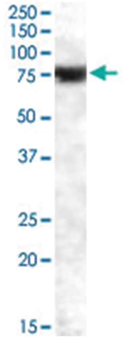 FEM1A, Goat, Polyclonal Antibody, Abnova 100&mu;g; Unlabeled:Antibodies,