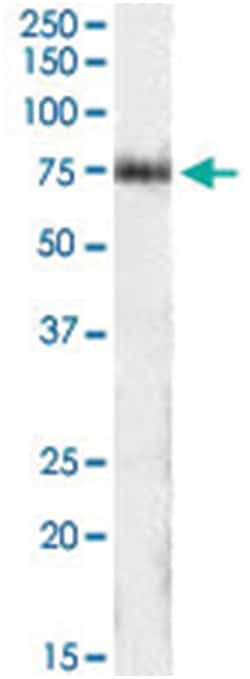 ITPKC, Goat, Polyclonal Antibody, Abnova 100 &mu;g | Buy Online | Abnova | Fisher Scientific