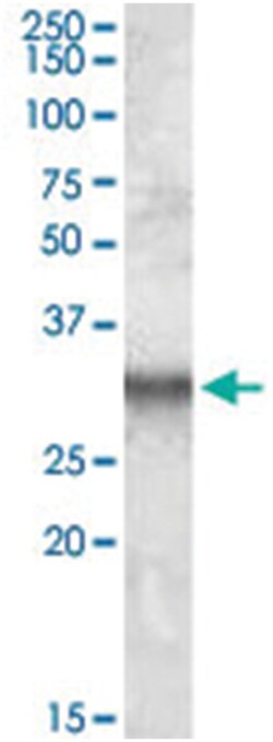 ITM2B, Goat, Polyclonal Antibody, Abnova 100&mu;g; Unlabeled:Antibodies,