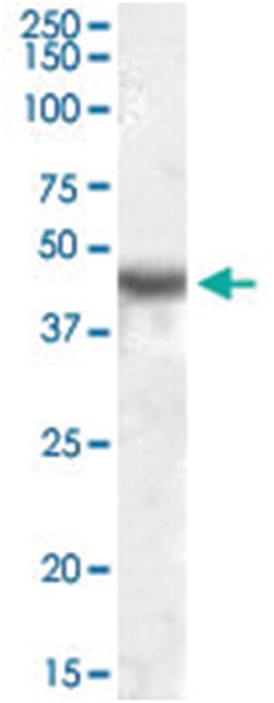 KCNJ1, Goat, Polyclonal Antibody, Abnova 100&mu;g; Unlabeled:Antibodies,