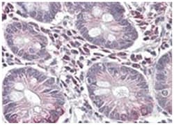 SLC10A2 Goat anti-Human, Polyclonal Antibody, Abnova 100&mu;g; Unlabeled:Antibodies,