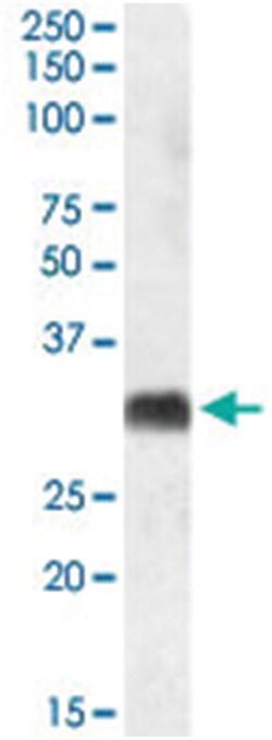 SRD5A2 Goat anti-Human, Polyclonal Antibody, Abnova 100 &mu;g | Buy Online | Abnova Corporation | Fisher Scientific