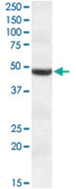 TMPRSS4 Goat anti-Human, Polyclonal Antibody, Abnova 100&mu;g; Unlabeled:Antibodies,