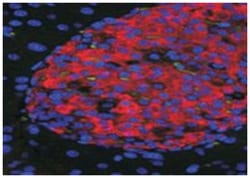 UNC5C, Goat, Polyclonal Antibody, Abnova 100 &mu;g | Buy Online | Abnova Corporation | Fisher Scientific