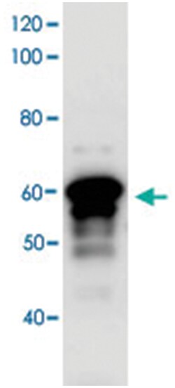 Myt1l, Rabbit, Polyclonal Antibody, Abnova 50&mu;g; Unlabeled:Antibodies,