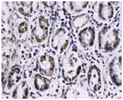 IL4 Rabbit anti-Human, Mouse, Rat, Polyclonal Antibody, Abnova 100 &mu;g | Buy Online | Abnova | Fisher Scientific