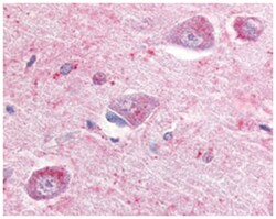 GPR22 Rabbit anti-Bovine, Chicken, Hamster, Horse, Human, Monkey, Mouse, Pig, Rabbit, Rat, Zebra fish, Polyclonal Antibody, Abnova 50 &mu;g | Buy Online | Abnova Corporation | Fisher Scientific