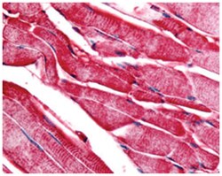 PYGM Rabbit anti-Human, Polyclonal Antibody, Abnova 50&mu;g; Unlabeled:Antibodies,