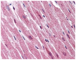 ADAMTS4 Rabbit anti-Dog, Horse, Human, Monkey, Polyclonal Antibody, Abnova