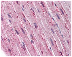 ADAMTS4 Rabbit anti-Dog, Horse, Human, Polyclonal Antibody, Abnova 50&mu;g;