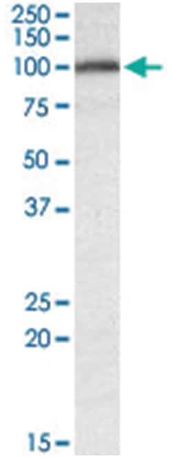 CANX, Goat, Polyclonal Antibody, Abnova 100 &mu;g | Buy Online | Abnova | Fisher Scientific