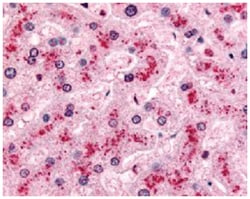 PYGL Rabbit anti-Dog, Human, Polyclonal Antibody, Abnova 50 &mu;g | Buy Online | Abnova Corporation | Fisher Scientific