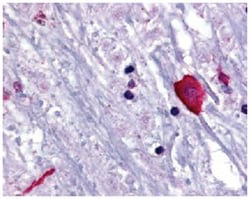 BRS3 Rabbit anti-Human, Monkey, Mouse, Rat, Polyclonal Antibody, Abnova