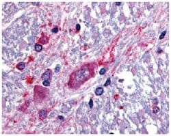 SLC5A3 Rabbit anti-Bovine, Dog, Human, Pig, Rabbit, Polyclonal Antibody,