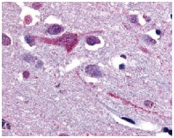 SLC5A9 Rabbit anti-Human, Polyclonal Antibody, Abnova 50&mu;g; Unlabeled:Antibodies,