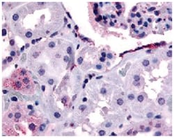 ERBB4 Rabbit anti-Hamster, Horse, Human, Monkey, Mouse, Polyclonal Antibody,