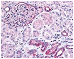 INPP5J Rabbit anti-Human, Polyclonal Antibody, Abnova 50 &mu;g | Buy Online | Abnova | Fisher Scientific