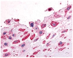 DDR1 Rabbit anti-Human, Monkey, Polyclonal Antibody, Abnova 50&mu;g; Unlabeled:Antibodies,