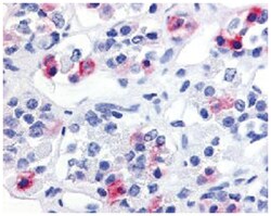 PRLHR Rabbit anti-Human, Mouse, Rat, Polyclonal Antibody, Abnova 50&mu;g;