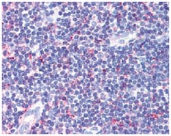 CCR4 Rabbit anti-Human, Monkey, Mouse, Rat, Polyclonal Antibody, Abnova