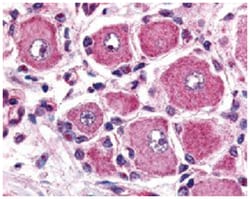 GPR149 Rabbit anti-Human, Monkey, Mouse, Rat, Polyclonal Antibody, Abnova