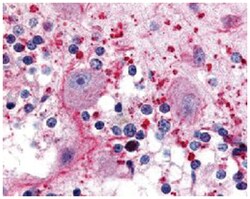 HTR5A Rabbit anti-Human, Mouse, Rat, Polyclonal Antibody, Abnova 50 &mu;g | Buy Online | Abnova Corporation | Fisher Scientific
