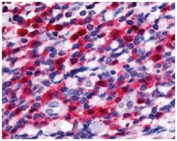 FLT3 Rabbit anti-Human, Polyclonal Antibody, Abnova 50&mu;g; Unlabeled:Antibodies,