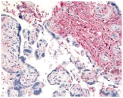 DPP4 Rabbit anti-Human, Polyclonal Antibody, Abnova 50 &mu;g | Buy Online | Abnova | Fisher Scientific