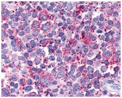 CX3CR1 Rabbit anti-Human, Mouse, Rat, Polyclonal Antibody, Abnova 50&mu;g;