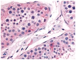 PTGES Rabbit anti-Bovine, Chicken, Dog, Horse, Human, Monkey, Pig, Rabbit, Rat, Zebra fish, Polyclonal Antibody, Abnova 50 &mu;g | Buy Online | Abnova | Fisher Scientific