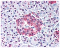 WNT10A, Rabbit, Polyclonal Antibody, Abnova 50&mu;g; Unlabeled:Antibodies,