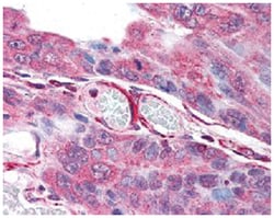 PLA2G3 Rabbit anti-Bovine, Human, Monkey, Pig, Polyclonal Antibody, Abnova