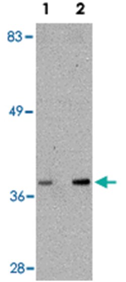 ALDH3A2, Rabbit, Polyclonal Antibody, Abnova 100 &mu;g | Buy Online | Abnova | Fisher Scientific