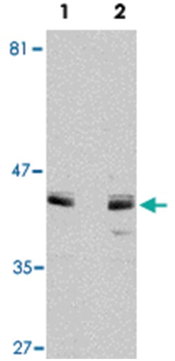 ACVR1 Rabbit anti-Human, Mouse, Polyclonal Antibody, Abnova 100&mu;g; Unlabeled:Antibodies,