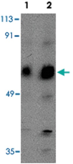 ACVR1 Rabbit anti-Human, Mouse, Rat, Polyclonal Antibody, Abnova 100&mu;g;