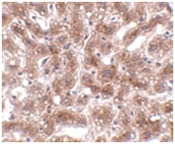 CUEDC1, Rabbit, Polyclonal Antibody, Abnova 100 &mu;g | Buy Online | Abnova | Fisher Scientific