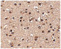 DACT2, Rabbit, Polyclonal Antibody, Abnova 100&mu;g; Unlabeled:Antibodies,