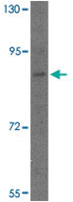 DACT2, Rabbit, Polyclonal Antibody, Abnova 100&mu;g; Unlabeled:Antibodies,