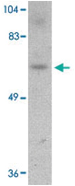 DACT3, Rabbit, Polyclonal Antibody, Abnova 100&mu;g; Unlabeled:Antibodies,