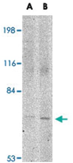 JPH1, Rabbit, Polyclonal Antibody, Abnova 100&mu;g; Unlabeled:Antibodies,