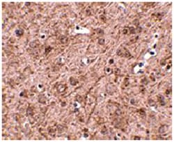 LASS6 Rabbit anti-Human, Mouse, Rat, Polyclonal Antibody, Abnova 100&mu;g;