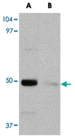 IL34 Rabbit anti-Human, Mouse, Rat, Polyclonal Antibody, Abnova 100 &mu;g | Buy Online | Abnova Corporation | Fisher Scientific