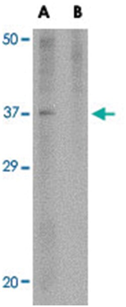 AKIRIN2 Rabbit anti-Human, Mouse, Polyclonal Antibody, Abnova 100&mu;g;