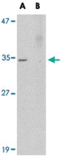 AKIRIN2 Rabbit anti-Human, Mouse, Rat, Polyclonal Antibody, Abnova 100&mu;g;