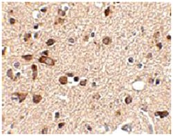 STK39 Rabbit anti-Human, Mouse, Rat, Polyclonal Antibody, Abnova 100&mu;g;