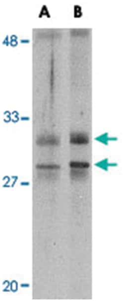 METTL7A Rabbit anti-Human, Mouse, Polyclonal Antibody, Abnova 100&mu;g;