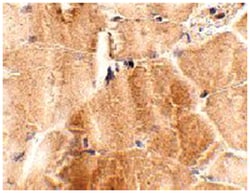 JPH2 Rabbit anti-Human, Mouse, Rat, Polyclonal Antibody, Abnova 100 &mu;g | Buy Online | Abnova Corporation | Fisher Scientific